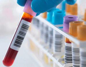 Blood Alcohol Test Process